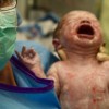 Hallazgo del gen de la respiración de los recién nacidos
