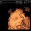 Los fetos bostezan en el útero