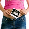 El ultrasonido detectaría el 80% de las malformaciones del feto