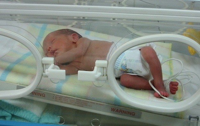 Factores que aumentan las chances de parto prematuro